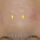 진성레이져 이미지