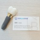 마곡베스트치과의원 네이버블로그