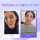 한남동제2경로당 | 한남동피부과 쥬베룩스킨 7일차 리얼 후기 !