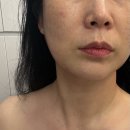 여신뷰티 | 울산 태화동 피부관리 샵 여신뷰티 온웨이브 리프팅 후기