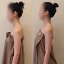 *미아.솔샘* 굽은등 라운드숄더 체형교정 미아 에스테틱 : 여우미 스킨케어