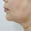 연세강연웅성형외과의원 이미지