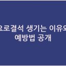 이유 이미지