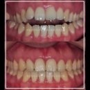 삐뚤한이바르게치과교정과치과의원 이미지