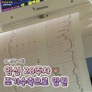 울산미즈병원 | [임신기록] 임신 28주차 조기수축으로 울산미즈병원 입원 후기(feat.라보파 부작용)