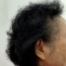 명품보청기 | 진안 보청기 착용하신 70대 어머님 솔직한 후기