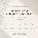 에스플랜의원 네이버블로그
