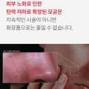 토너패드 추천 &#39;멜락신 BP모공패드&#39;모공축소 관리템이네요