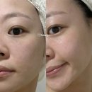 더널리 | 건조한 피부 겨울필수템 널리 제주선인장 토너미스트 사용 후기