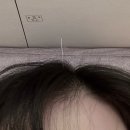 온기한의원 | 서면역 한의원 추천 : 위너 한의원에서 따끈한 쑥뜸 치료받고 온 솔직 리뷰