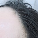 김헤어라인 이미지