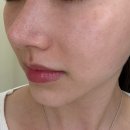 바르는 필러? 얼굴살찌는법 세멘잘라이트로 꺼진 볼살 다시 채우기