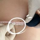 스킨앤미 | 대구 수성구 리프팅관리 잘하는 곳 ㅣ골든W스킨앤왁싱 미레브 온다 리프팅 솔직 후기