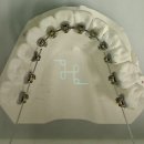 주맘교정치과기공소 이미지