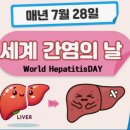 세계 간염의 날 이미지