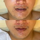 도도앤뷰티 | 천안 불당동 ‘도도뷰티앤왁싱’에서 여드름 관리 추천 후기