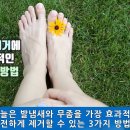 “속는셈치고 한번만 해보세요” 무좀과 발톱무좀에 소금과 이것을 뿌려주기만 하면 말끔히 사라집니다! 이미지