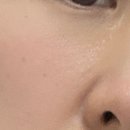 리노성형외과의원 네이버블로그