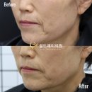 에이지솔루션 이미지