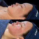 레티나메디칼 | 요즘 연예인들이 몰래 받는다는 ‘슈퍼젝션’… 진짜 효과 있을까?”