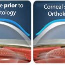 드림안경 콘택트 이미지
