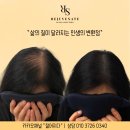 군산두피문신후기, 자연스러울 수 있는 이유?