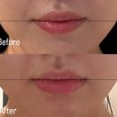 금손 | 화명동에스테틱 화명동윤곽관리추천 얼굴이작아지는 금손에스테틱 리얼후기