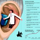 소리안보청기 네이버블로그