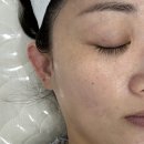 에스왁싱(S왁싱) | 평택 안중 여드름 피부관리 에스왁싱에서 여드름 압출 받고 완전 만족한 후기✨