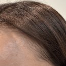 소이블랑 | 전포왁싱 전문샵 소이블랑 waxing 잘하는 곳 헤어라인 후기