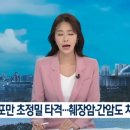 중입자치료지원센터 | 중입자 가속기 암세포만 골라 초정밀 타격+간암+췌장암까지 확대