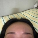 나무약국 | [2탄] 용인 처인구 편평사마귀 제거 후기 '내돈내산' <시술, 통증, 회복 과정 총정리>