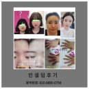 위라온인셀덤 | 라온S뷰티 인셀덤 피부 속에서 만들어지는 자신감!