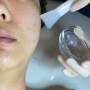 오토오아시스김포한강신도시점 | 김포트러블 관리 후기, 압출부터 수분까지! 피부의정석