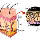 Re:입술 헐었는데 ~편평상피세포암의 발생부위 이미지