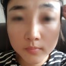 수원-0562 | 권선동 피부관리 에스뷰티에서 맞춤 케어 받고 온 후기