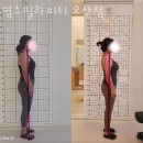 영스필라피티