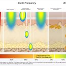 안티에이징의원 이미지