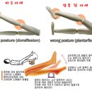 통나무Ⅱ 이미지