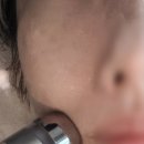 미케어 | 역삼피부관리 케어바이미여배우관리 솔직후기