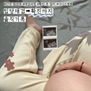서현2층약국 | 성남 더미즈병원 / 임당 재검 ⮕ 확진까지 솔직 기록 💉