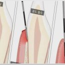 대한치과의원 | 라페치과의원 교하점에서의 치과 치료 후기