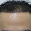 모먼트의원 이미지