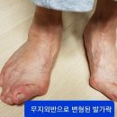 팔팔 두발로
