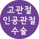 고관절염의 원인과 증상 그리고 치료법 ＜고관절/ 고관절인공관절수술 / 고관절염 /고관절수술 /고관절통증/대퇴골두무혈성괴사＞ 이미지