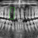 송탄바른치과의원 이미지