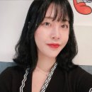 보조개 시술받은 후기