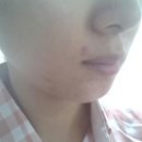 오렌지한의원 이미지