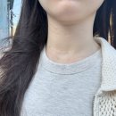 남경주IC(울산) | 울산 경주 피부과 추천 목주름필러 내돈내산 효과 후기