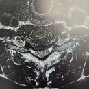 아중푸름신경외과의원 | 경추척수증? 디스크일때 관리해야 합니다 &lt;실제 사례&gt;
